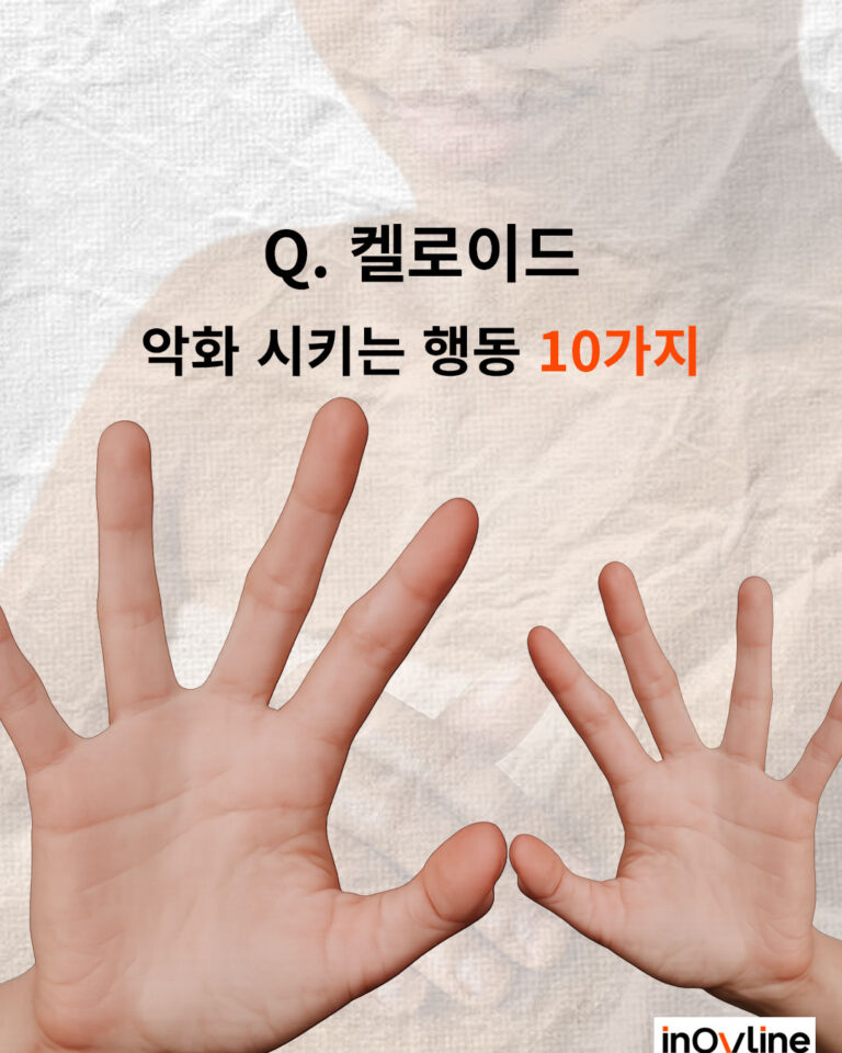 켈로이드 악화 시키는 행동 10가지
