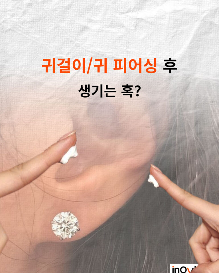 귀걸이, 귀 피어싱 후 생기는 혹?